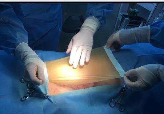 1 Antibacterial Iodophor-containing Surgical Drape for Animal Operations