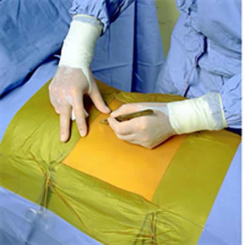 3 Antibacterial Iodophor-containing Surgical Drape for Animal Operations