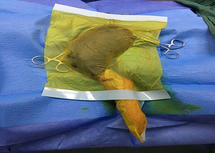 4 Antibacterial Iodophor-containing Surgical Drape for Animal Operations