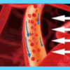 IWA-RLT40 — illustration of improved local circulation after IWA-RLT40 — illustration of improved local circulation after red light therapy