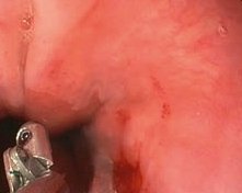 IWA-HD10 Multifunctional Veterinary Electronic Gastroscope