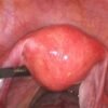 图55_第13页_三平动物内窥镜中文折页v2.2 IWA-HD60 Portable Veterinary Rigid Endoscope (200 MP / 4K)