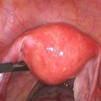图55_第13页_三平动物内窥镜中文折页v2.2 IWA-HD60 Portable Veterinary Rigid Endoscope (200 MP / 4K)