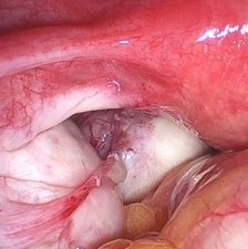 图56_第13页_三平动物内窥镜中文折页v2.2 IWA-HD60 Portable Veterinary Rigid Endoscope (200 MP / 4K)
