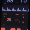 VE4 4-inch display close-up - SpO2 and PR values with plethysmogram, ETCO2, FiCO2 and airway respiration rate with capnogram