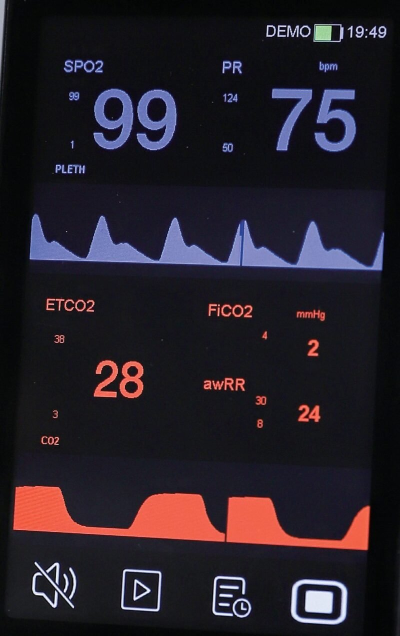 VE4 4-inch display close-up - SpO2 and PR values with plethysmogram, ETCO2, FiCO2 and airway respiration rate with capnogram