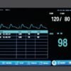 VE5 monitor display close-up - plethysmogram, NIBP result list, SpO2 and PR values and touch menu bar
