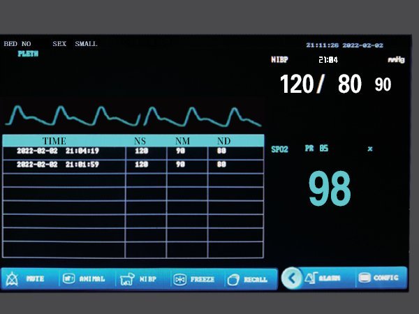 VE5 monitor display close-up - plethysmogram, NIBP result list, SpO2 and PR values and touch menu bar