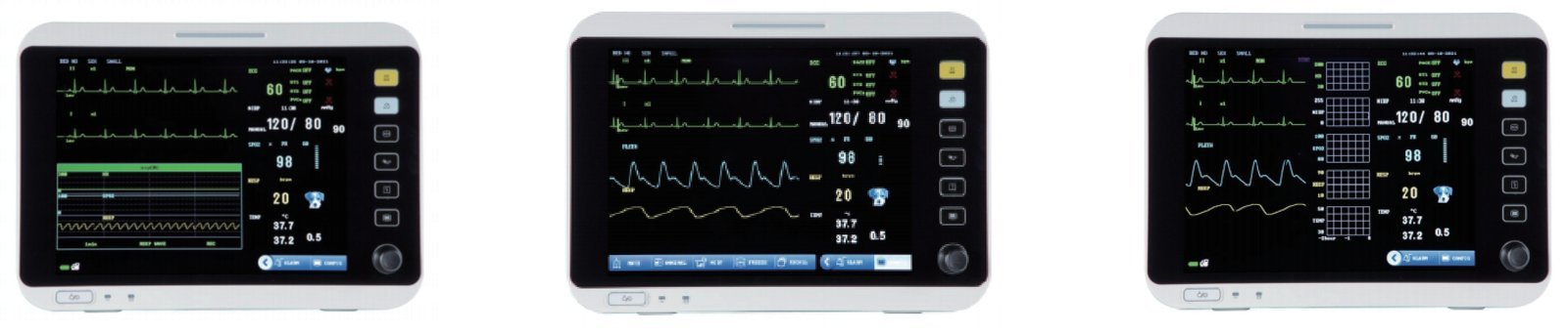 VM12 veterinary monitor display modes: oxyCRG, standard waveform and trend views